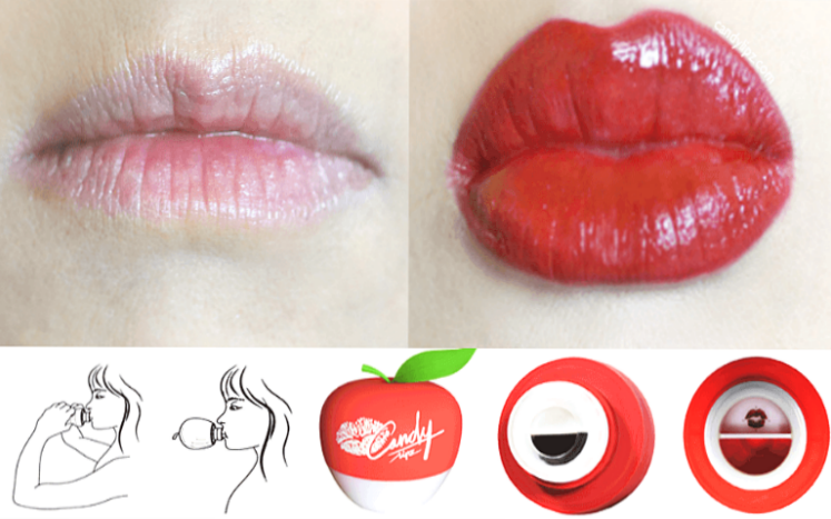 Upper Lip Wrinkles - Get Rid of Wrinkles - Restylane Lip Filler Cream